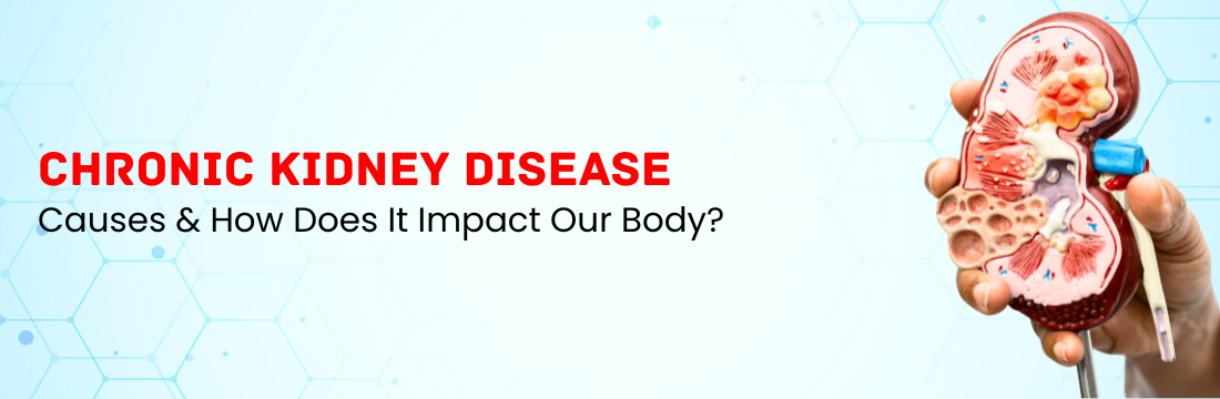 Chronic Kidney Disease: Causes, and How does it impact our body?